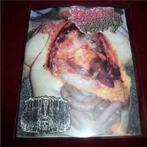 Gential Herpes, Butyric Fermentation Abuse - Split download free